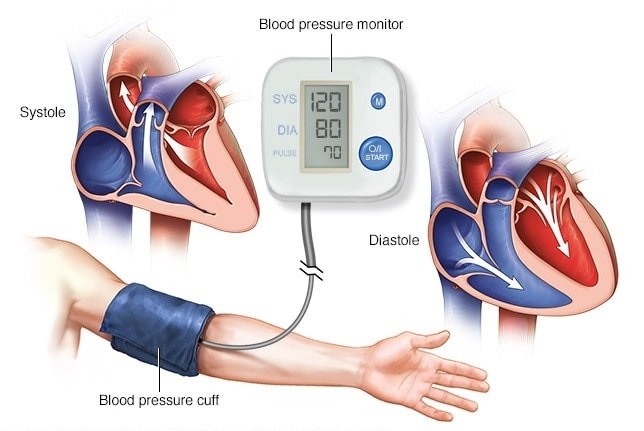Chế độ dinh dưỡng và luyện tập hàng ngày cho bệnh nhân tăng huyết áp